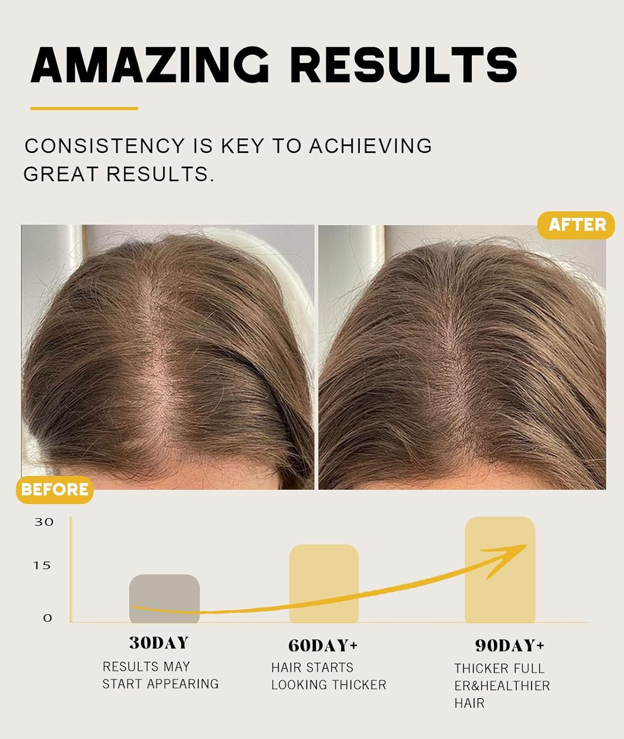 Batana Oil for Hair Growth - 100% Pure Natural Paste from Honduras, Prevents Hair Loss and Enhances Thickness, Organic Raw Hair Mask for Men and Women (4.05 Oz)